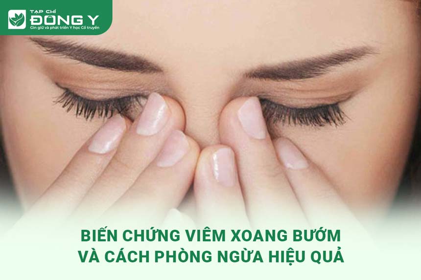 bien-chung-viem-xoang-buom