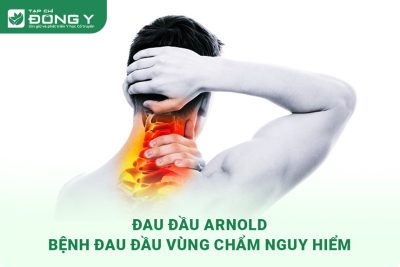 dau dau arnold