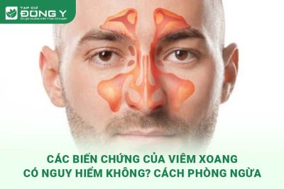 cac-bien-chung-cua-viem-xoang