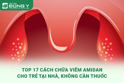 cach-chua-viem-amidan-cho-tre-tai-nha