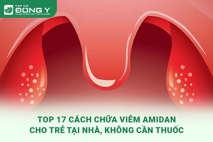 cach-chua-viem-amidan-cho-tre-tai-nha