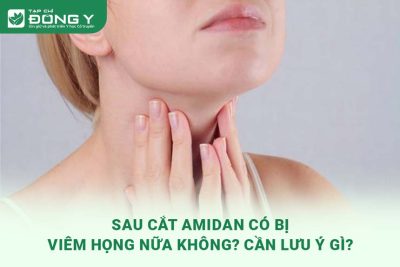 cat-amidan-co-het-viem-hong