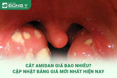 cat-amidan-gia-bao-nhieu