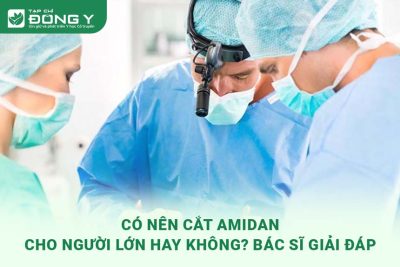 co-nen-cat-amidan-cho-nguoi-lon