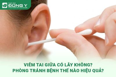 viem-tai-giua-co-lay-khong