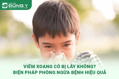 viem-xoang-co-bi-lay-khong