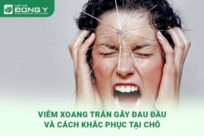 viem-xoang-tran-gay-dau-dau