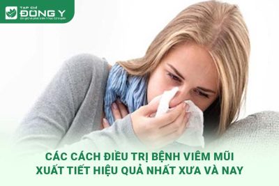 cach-dieu-tri-benh-viem-mui-xuat-tiet