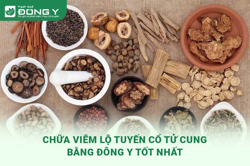 chua-viem-lo-tuyen-co-tu-cung-bang-dong-y