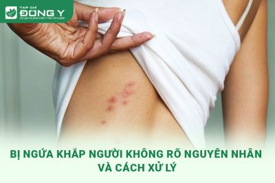 Bị Ngứa Khắp Người Không Rõ Nguyên Nhân