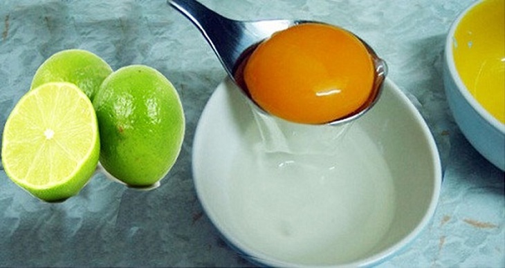 Chữa vẩy nến bằng lòng đỏ trứng gà, kết hợp chanh và dầu olive