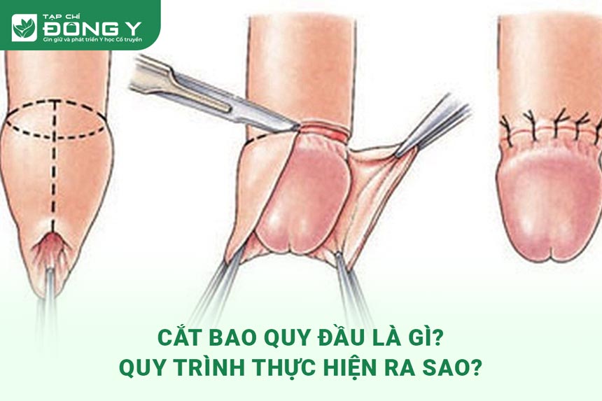 cat-bao-quy-dau