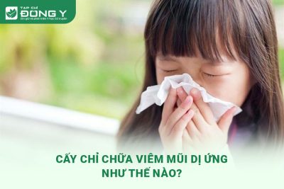 cay-chi-chua-viem-mui-di-ung
