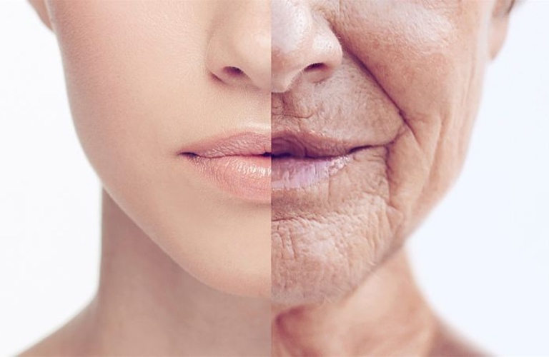 Da khô nhăn nheo là tình trạng da thiếu nước trầm trọng