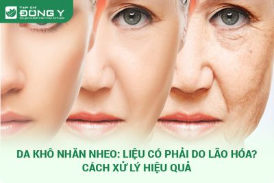 da khô nhăn nheo