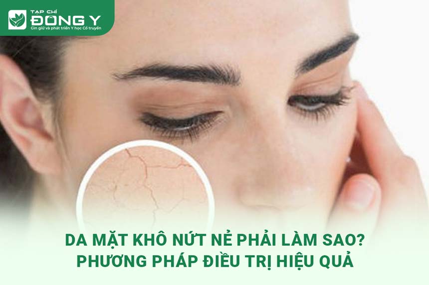 da-mat-kho-nut-ne-phai-lam-sao