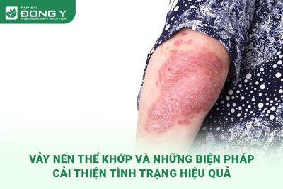 vay-nen-the-khop