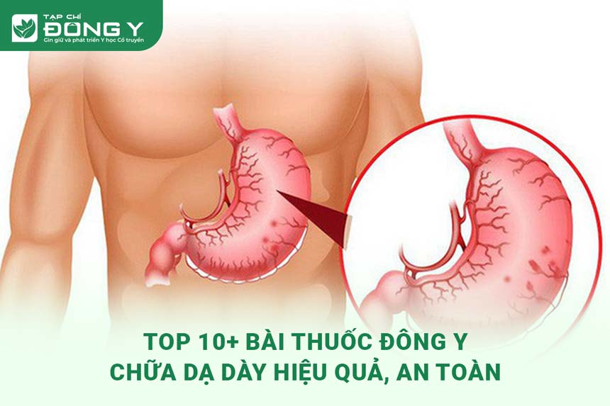 bai-thuoc-dong-y-chua-da-day