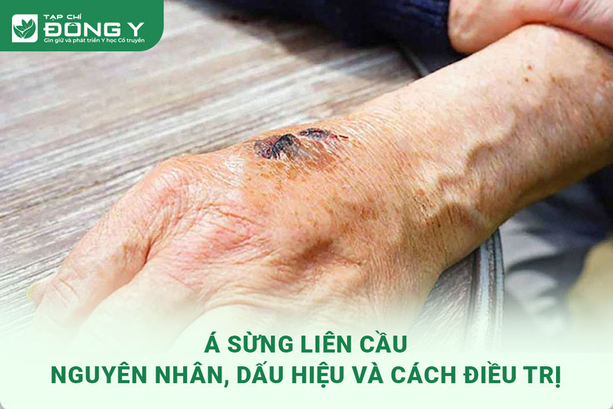 a sung lien cau