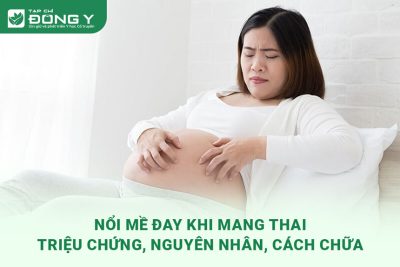 benh-me-day-khi-mang-thai