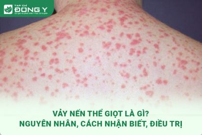 vay nen the giot