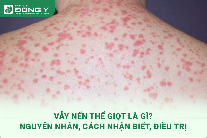 vay nen the giot