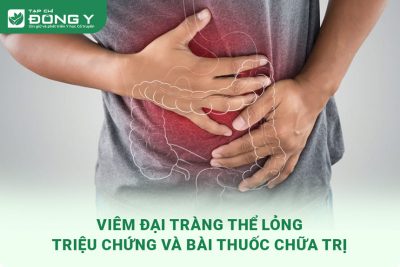 viem dai trang the long