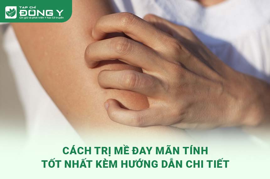 cach-tri-me-day-man-tinh