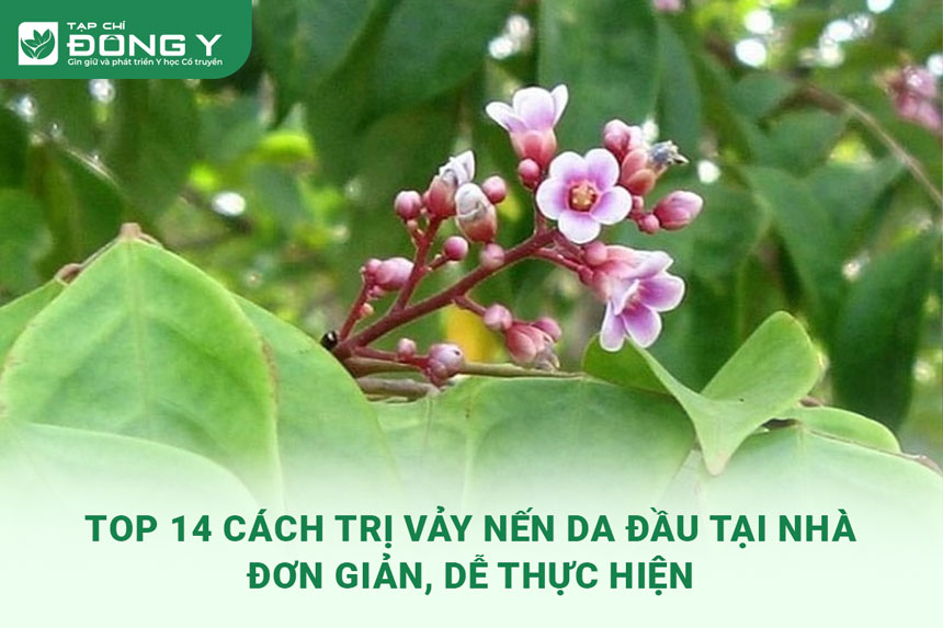 cach-tri-vay-nen-da-dau-tai-nha