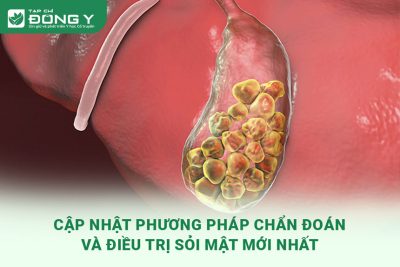 chan-doan-va-dieu-tri-soi-mat
