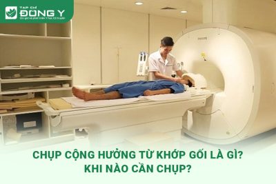cong-huong-tu-khop-goi