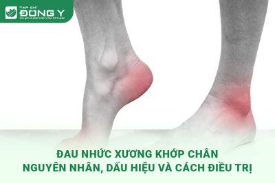 dau-nhuc-xuong-khop-chan