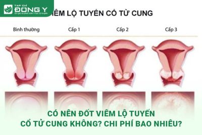 dot-viem-lo-tuyen-co-tu-cung