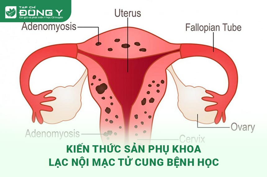noi-mac-tu-cung