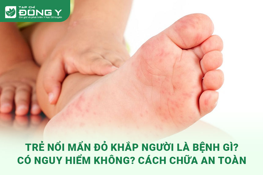 tre-noi-man-do-khap-nguoi