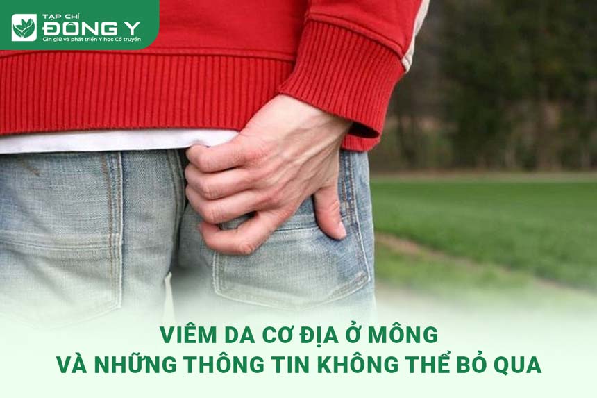 viem-da-co-dia-o-mong
