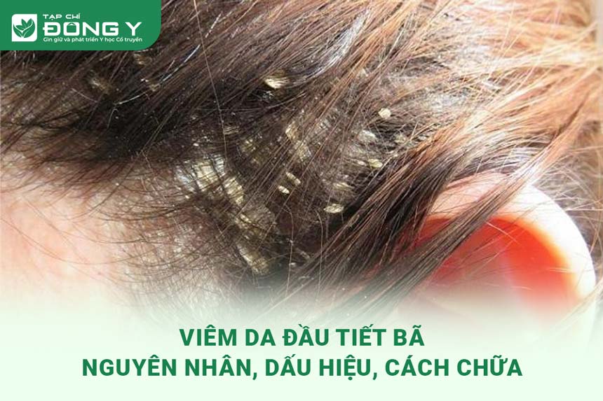 viem-da-dau-tiet-ba