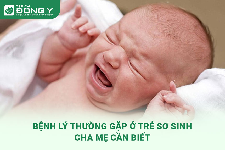 benh-ly-thuong-gap-o-tre-so-sinh