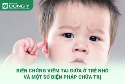 bien-chung-viem-tai-giua