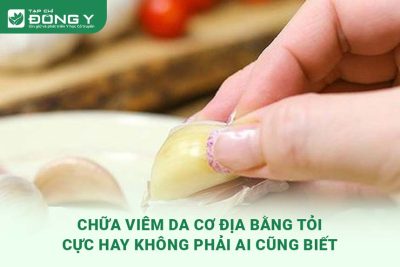 chua-viem-da-co-dia-bang-toi