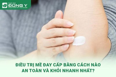 dieu-tri-me-day-cap