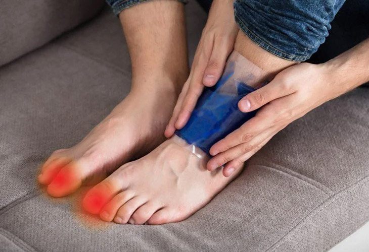 gout-cap-tinh