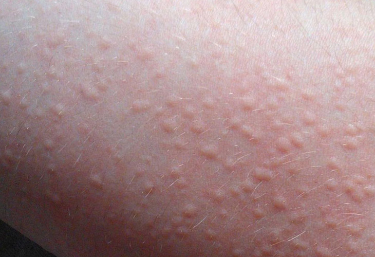 me-day-cholinergic