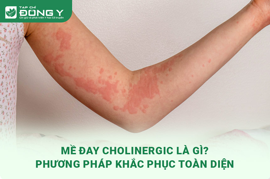 me-day-cholinergic