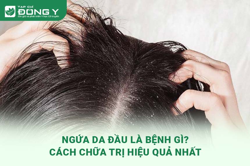 ngua-da-dau