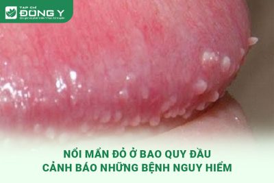 noi-man-do-o-bao-quy-dau