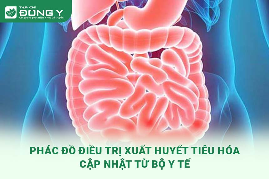 phac-do-dieu-tri-xuat-huyet-tieu-hoa