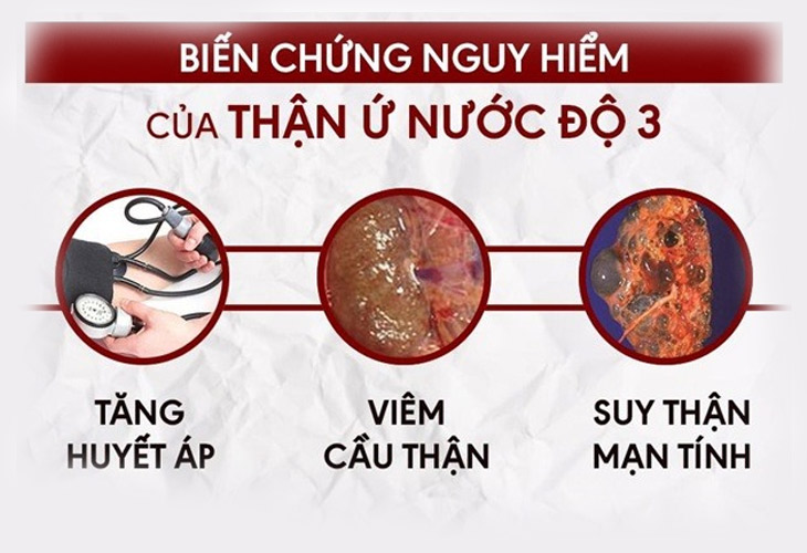 suy-than-do-3