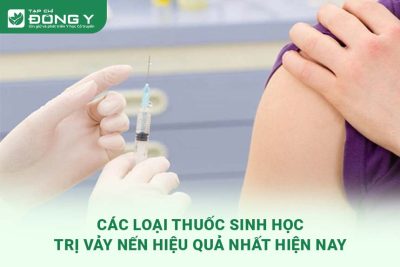 thuoc-sinh-hoc-tri-vay-nen