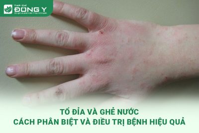 to-dia-va-ghe-nuoc